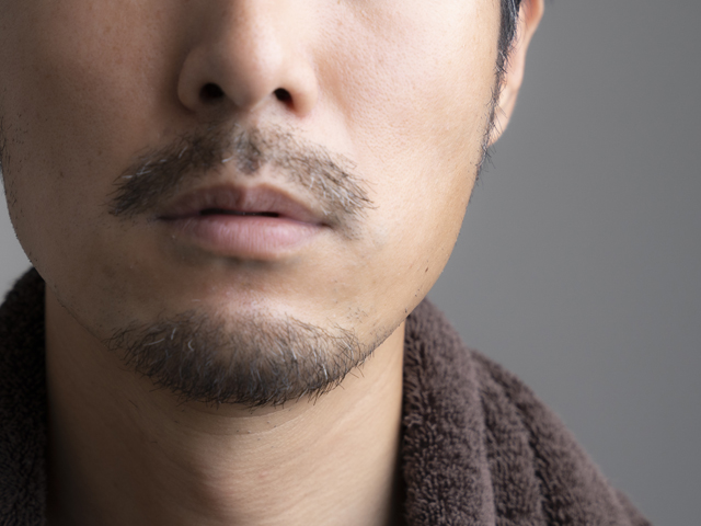 剛毛なら医療脱毛がオススメの5つの理由