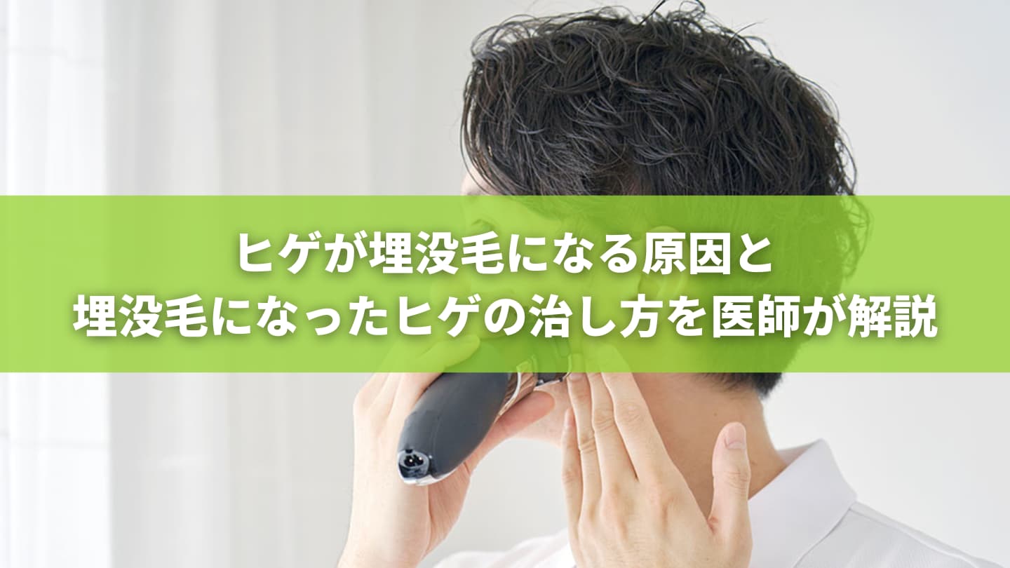 ヒゲが埋没毛になる原因と埋没毛になったヒゲの治し方を医師が解説