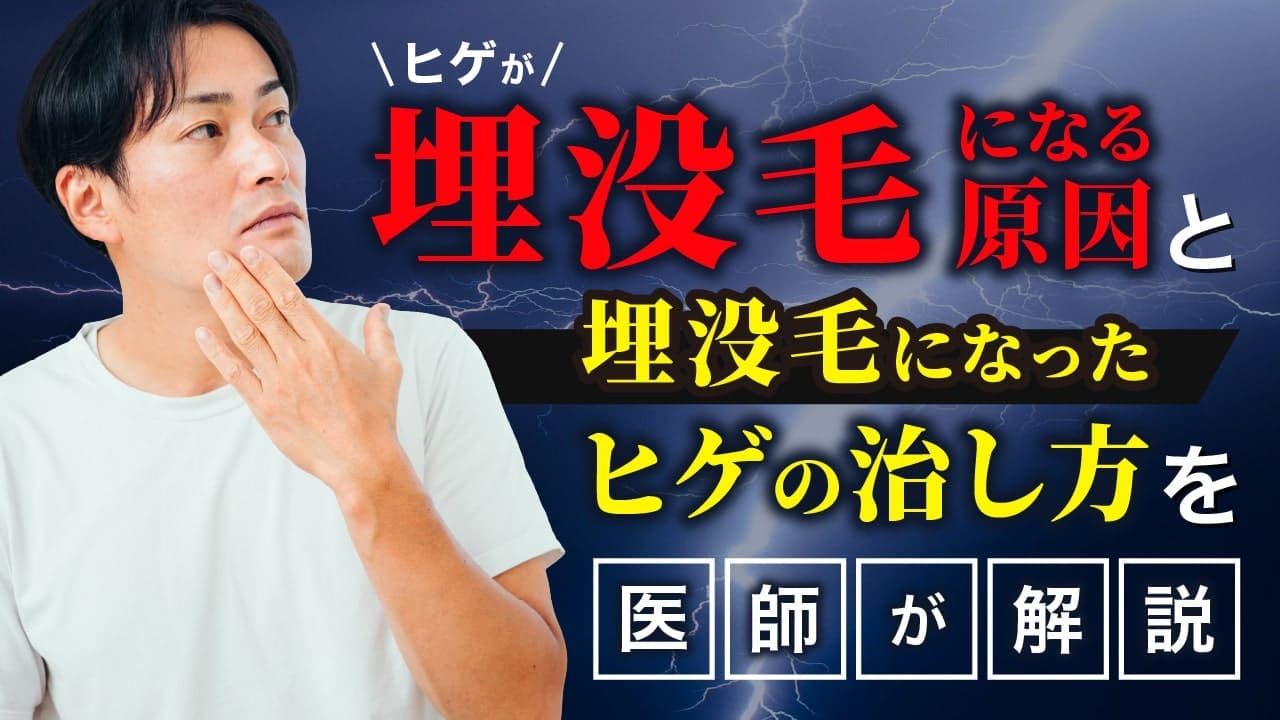 ヒゲが埋没毛になる原因と埋没毛になったヒゲの治し方を医師が解説