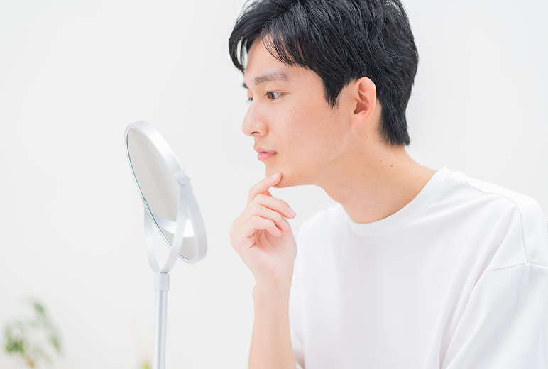 ニキビ跡治療のイメージ