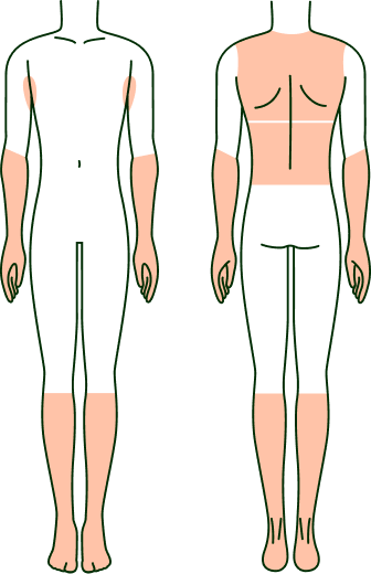 ルシアクリニックfor MEN 脱毛部位