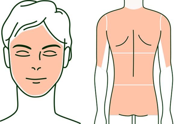 ケミカルピーリング 脱毛部位