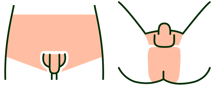 メンズVIO脱毛プラン 脱毛部位