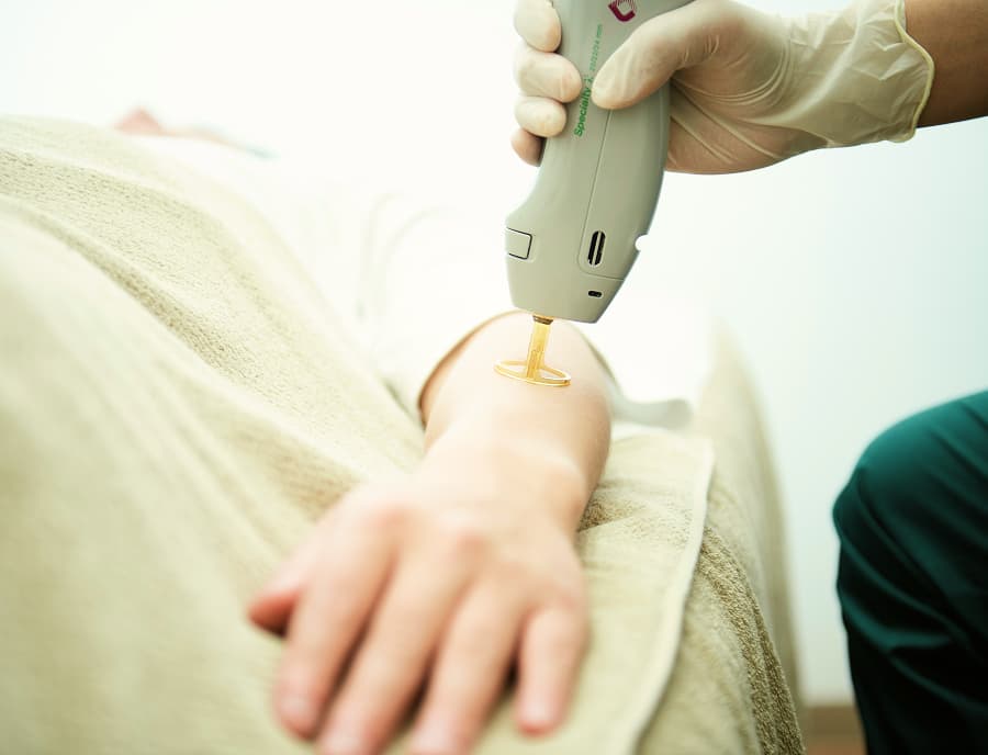 メンズルシアの施術の様子