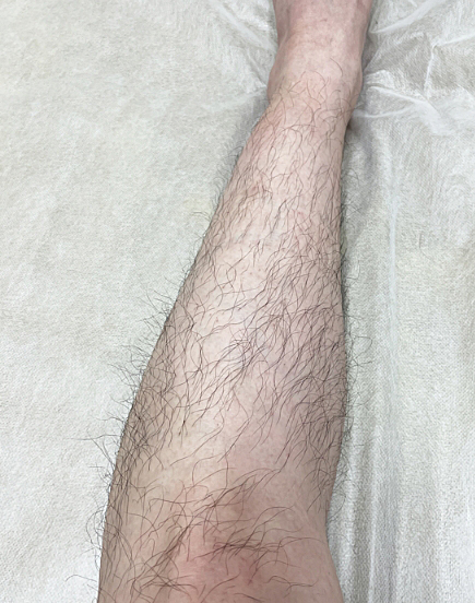 照射前の画像