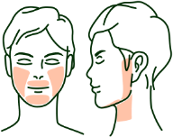 ヒゲ脱毛