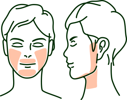 ヒゲ脱毛 脱毛部位