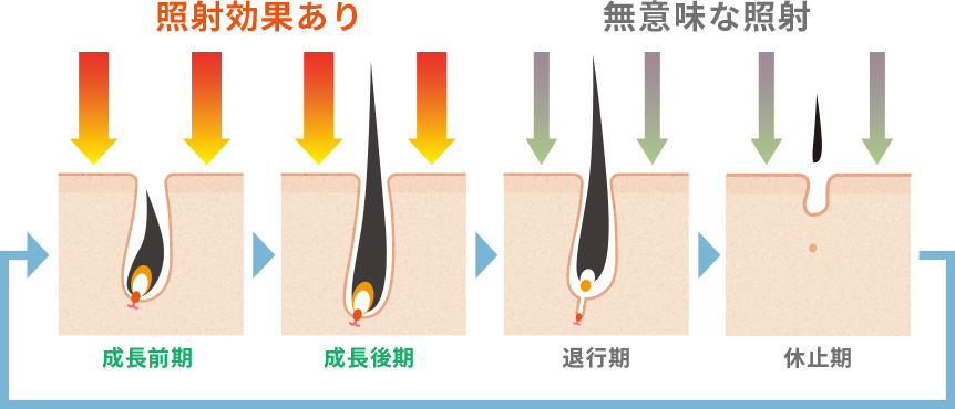毛周期に合わせた照射