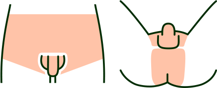 全身脱毛＋VIO 全部位