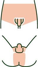 全身脱毛＋ヒゲ＋VIO 全部位