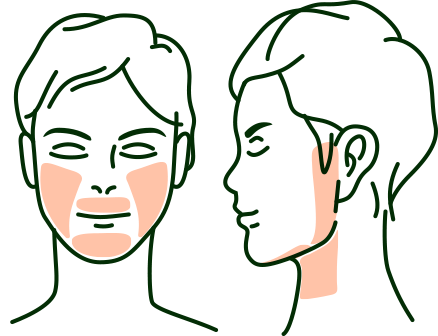 ヒゲ脱毛 選べる3部位